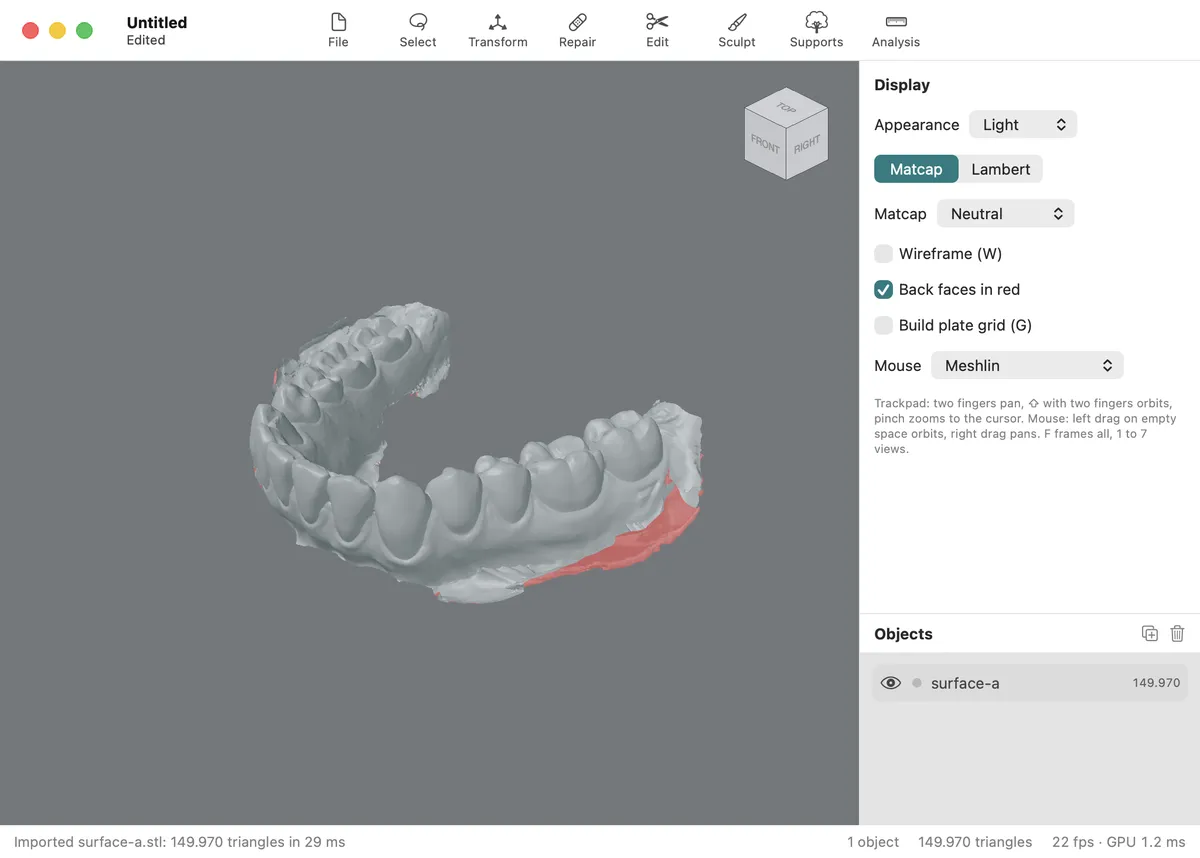 Meshlin with an intraoral scan of a dental arch