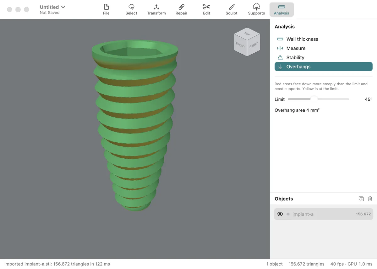 Overhang analysis on an implant scan