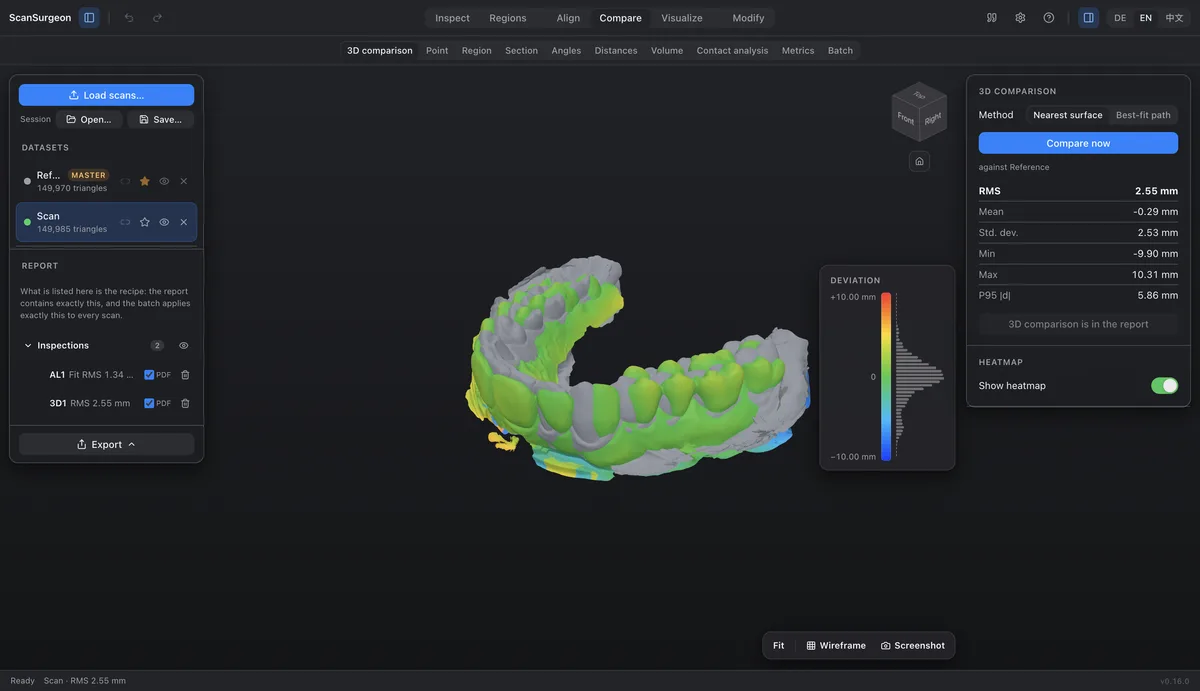ScanSurgeon comparing two scans of a dental arch as a heat map
